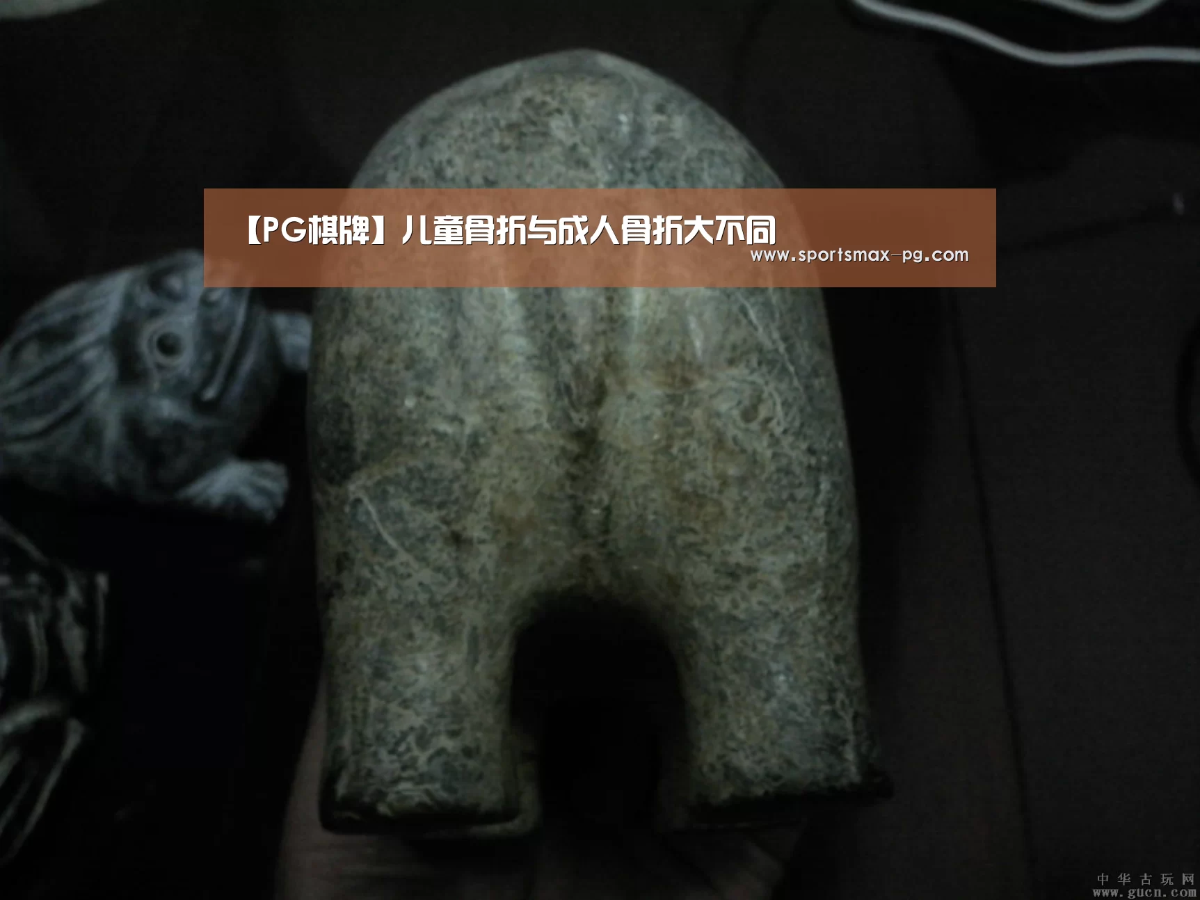 【PG棋牌】儿童骨折与成人骨折大不同(图3) PG电竞APP